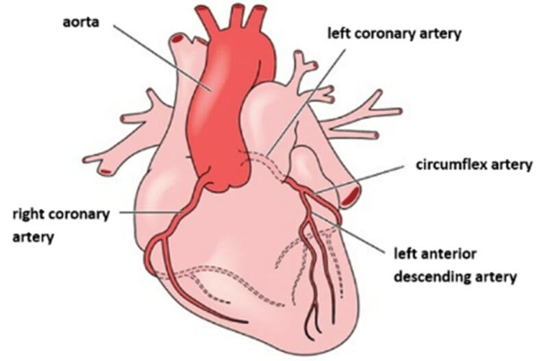 right coronary artery right coronary artery